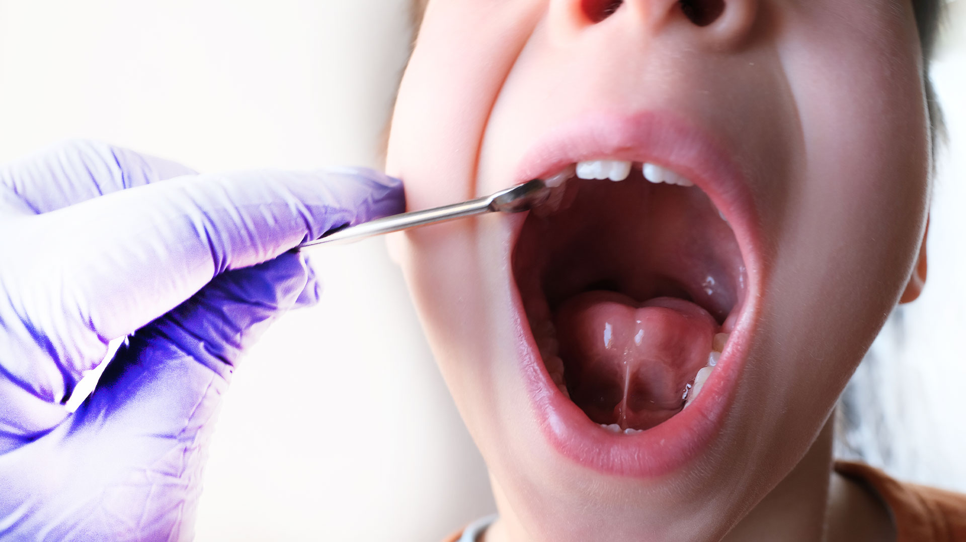 The Kids  Dentist Tucson | Special Needs Dentistry, Lip and Tongue Ties and Restorative Dentistry